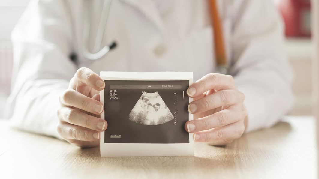 Doctor holding a picture of an ultrasound picture.